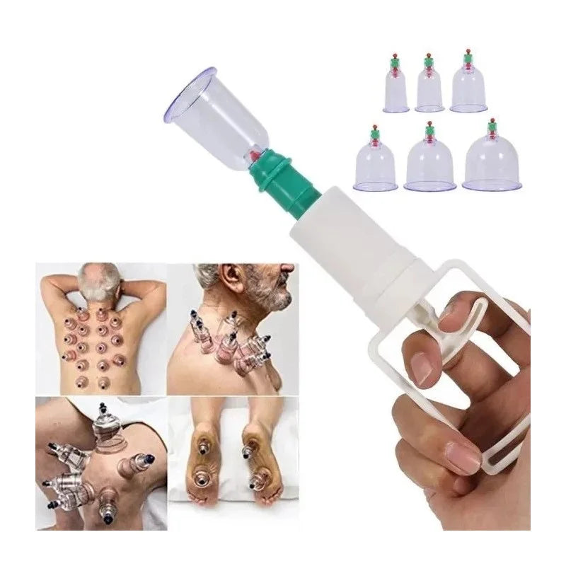 Professional Hijama Suction Cups – 6 Sizes: 3 to 7cm | Release Valve